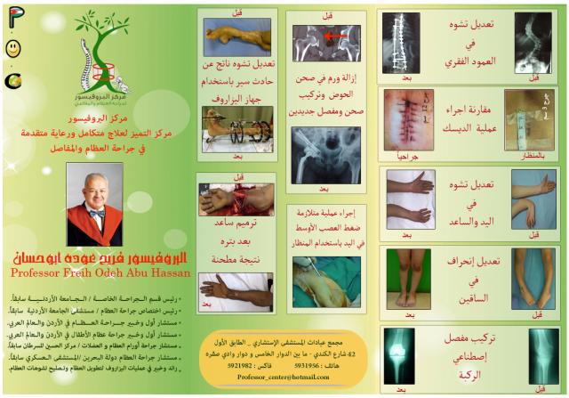أشطر دكتور عظام في الاردن

www.prof-abuhassan.com